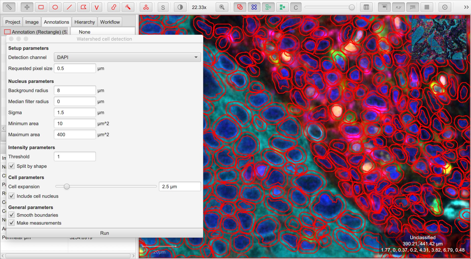 ../../_images/multiplex_cells.jpg