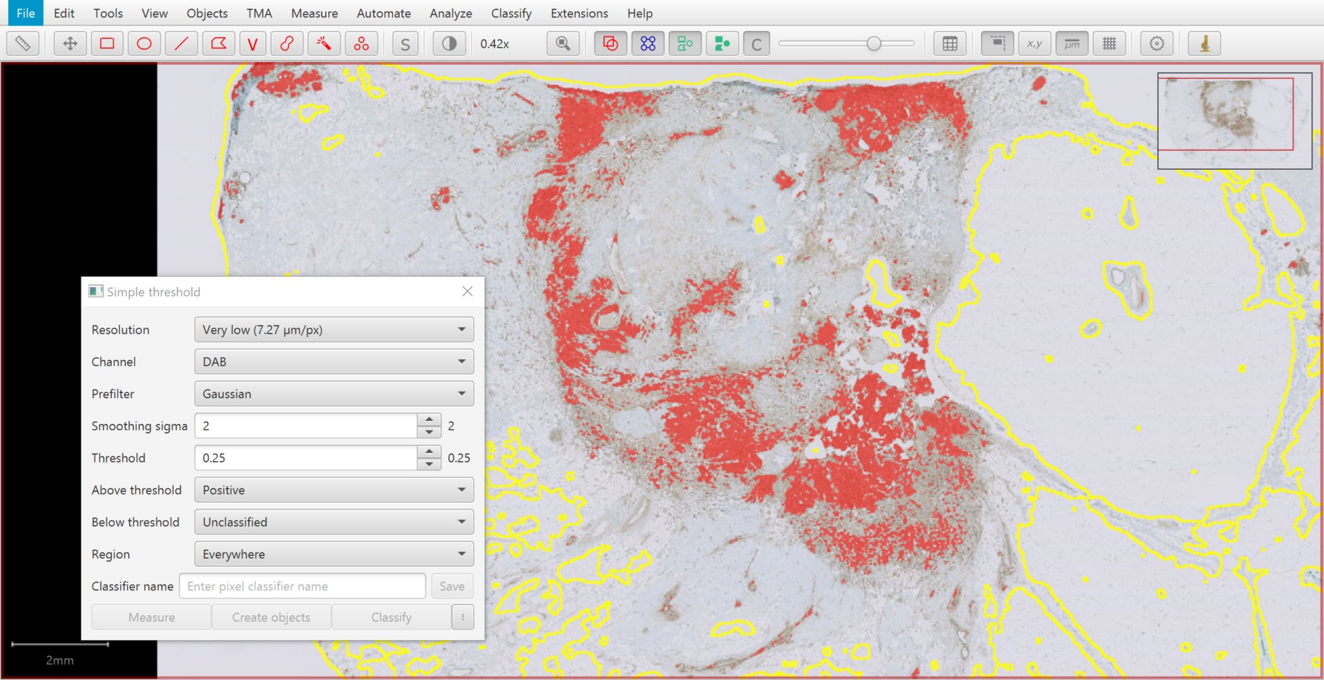 ../../_images/areas_preview.jpg
