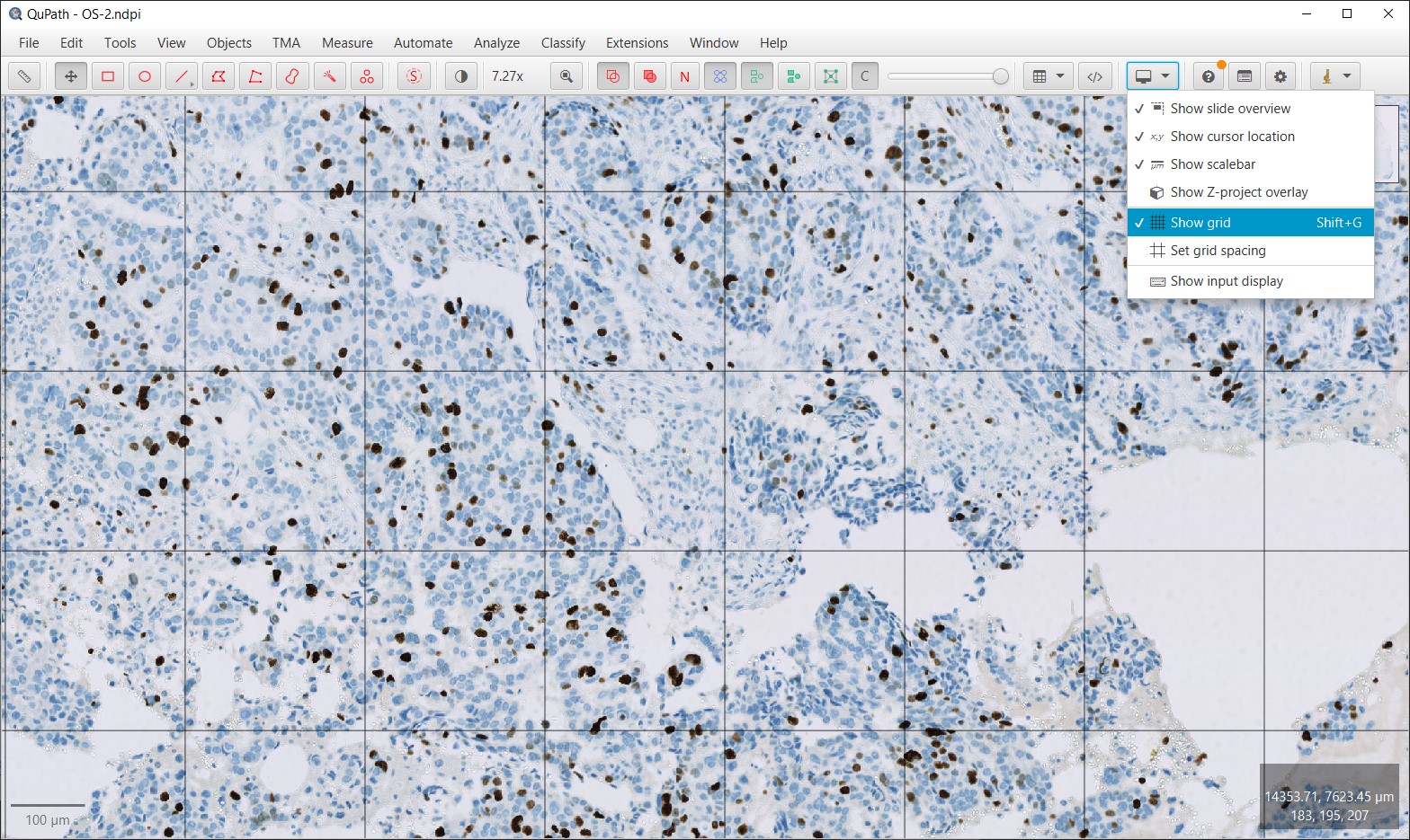 ../../_images/counting_grid.jpg