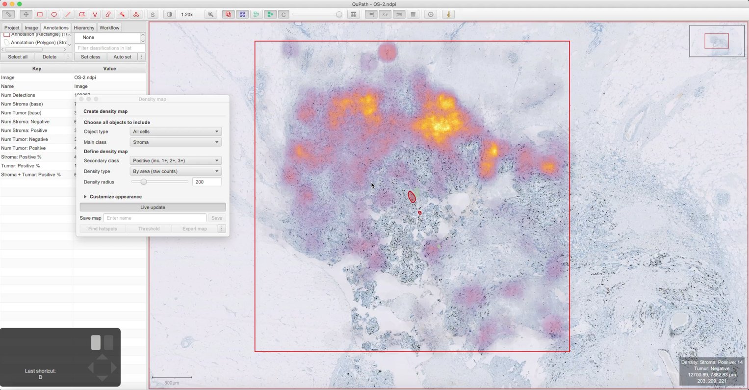 ../../_images/density_map_stroma_positive.jpg