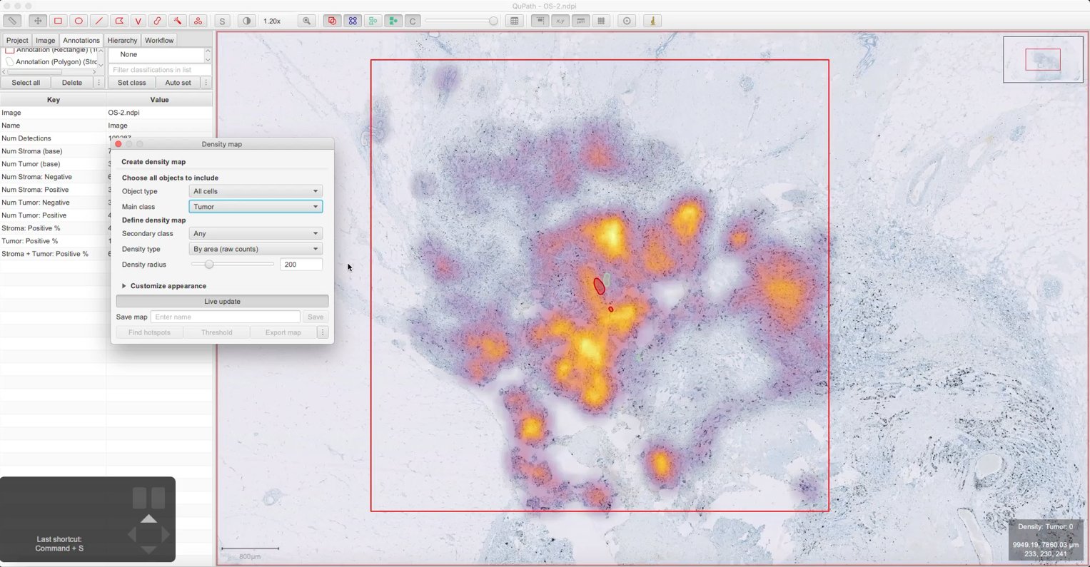 ../../_images/density_map_tumor.jpg