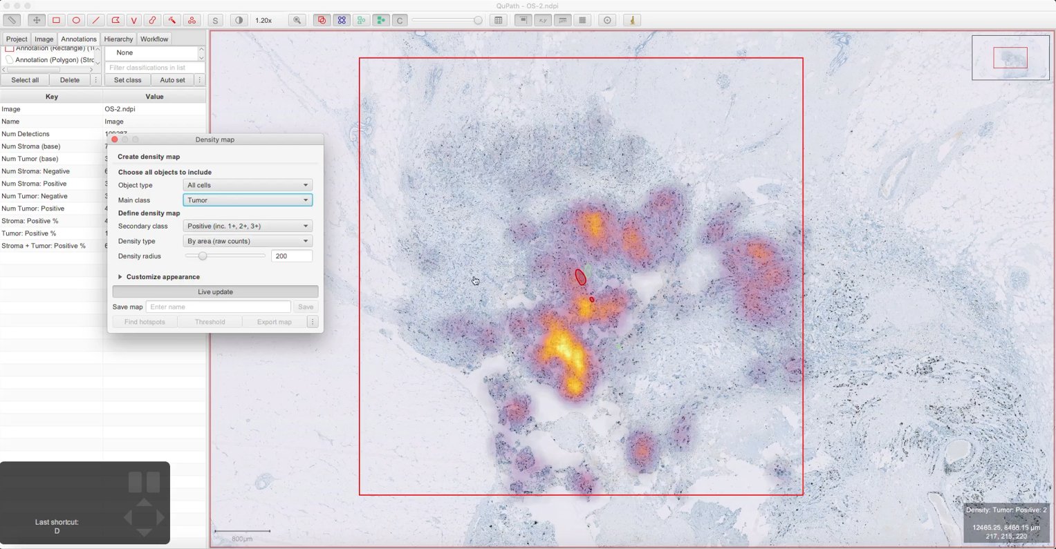 ../../_images/density_map_tumor_positive.jpg