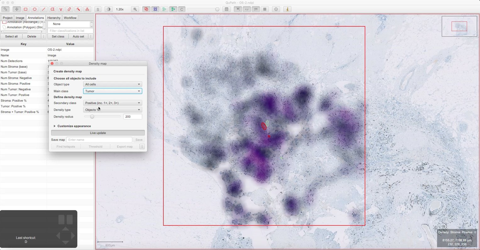 ../../_images/density_map_tumor_positive_percent.jpg