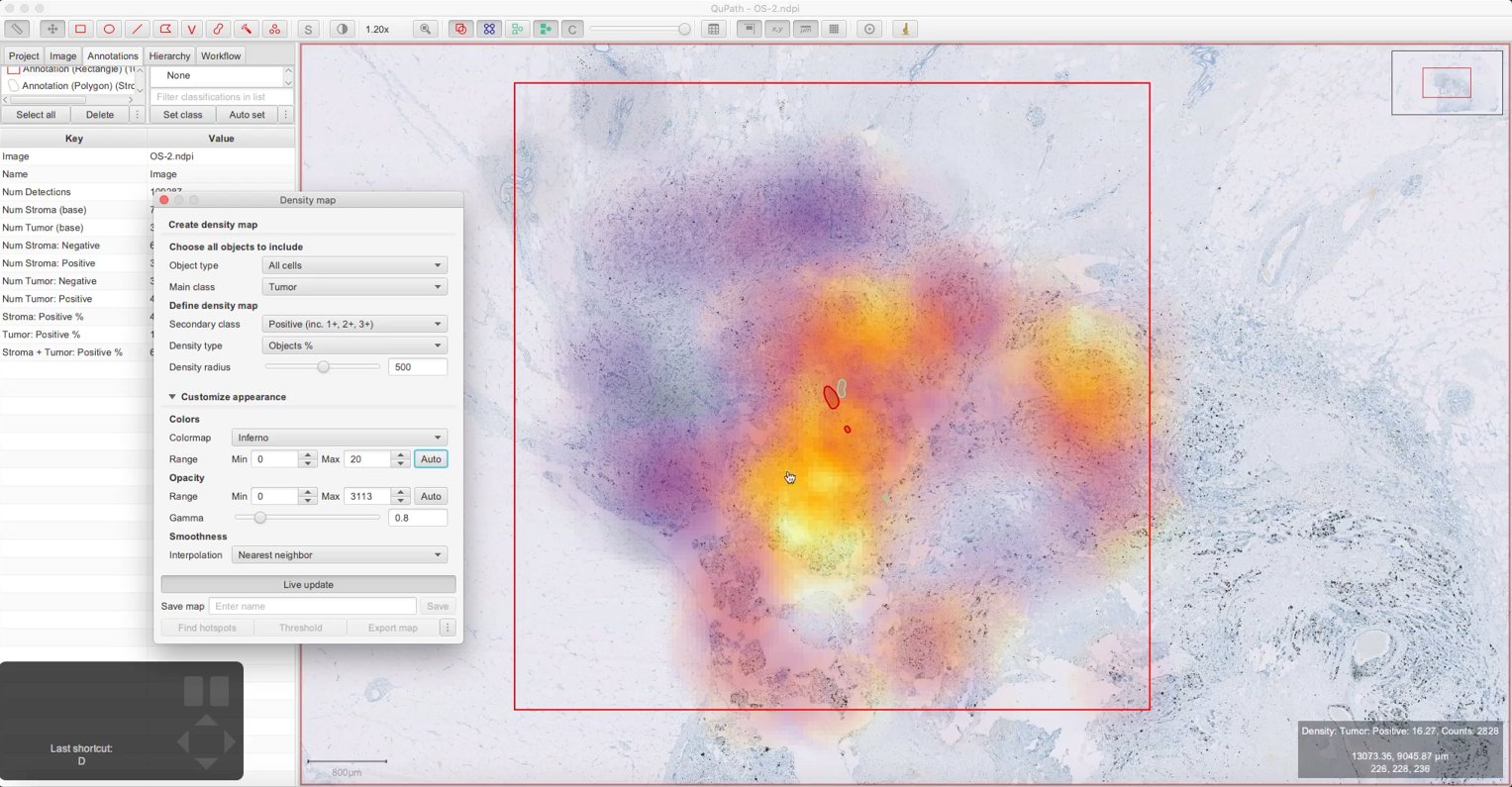 ../../_images/density_map_tumor_positive_percent_adjusted.jpg