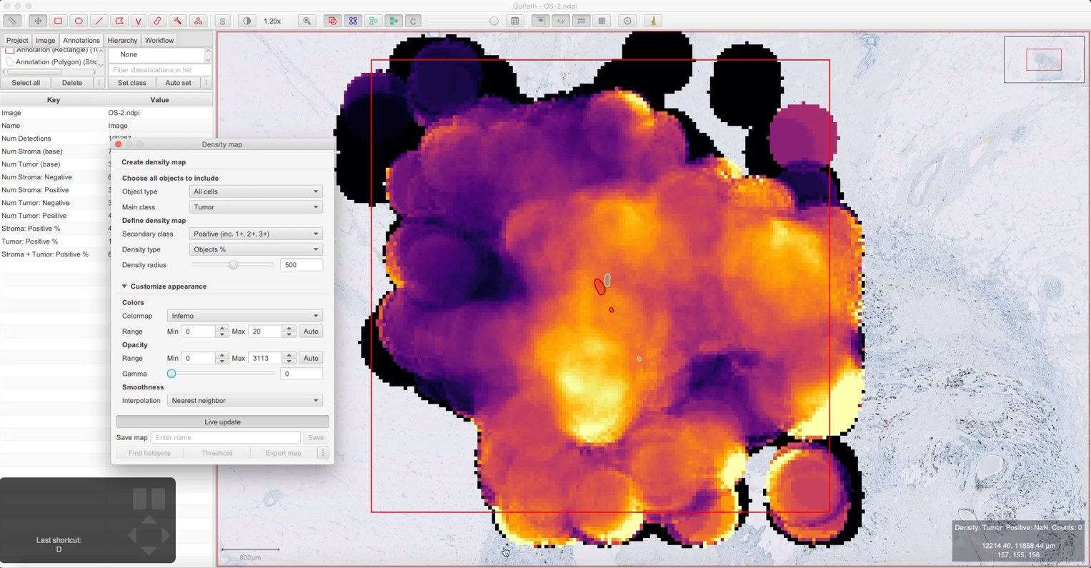 ../../_images/density_map_tumor_positive_percent_opaque.jpg