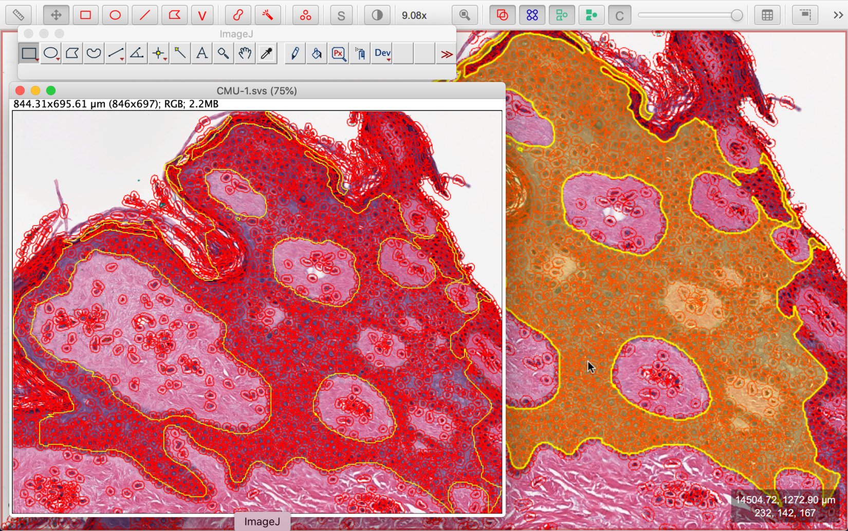 ../../_images/imagej_objects.jpg
