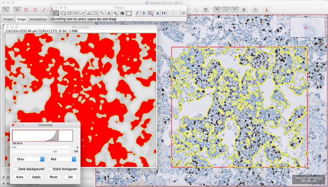 ../../_images/imagej_return_roi.jpg