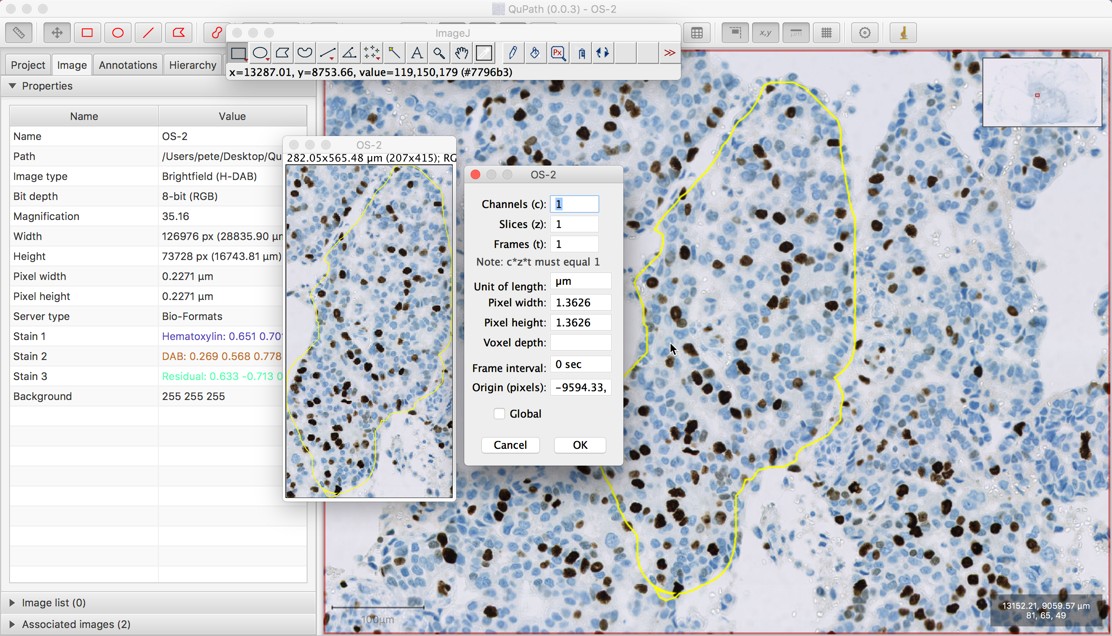 ../../_images/imagej_send_region.jpg