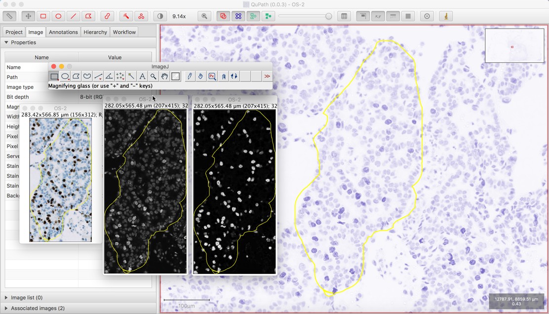 ../../_images/imagej_send_transformed_region.jpg
