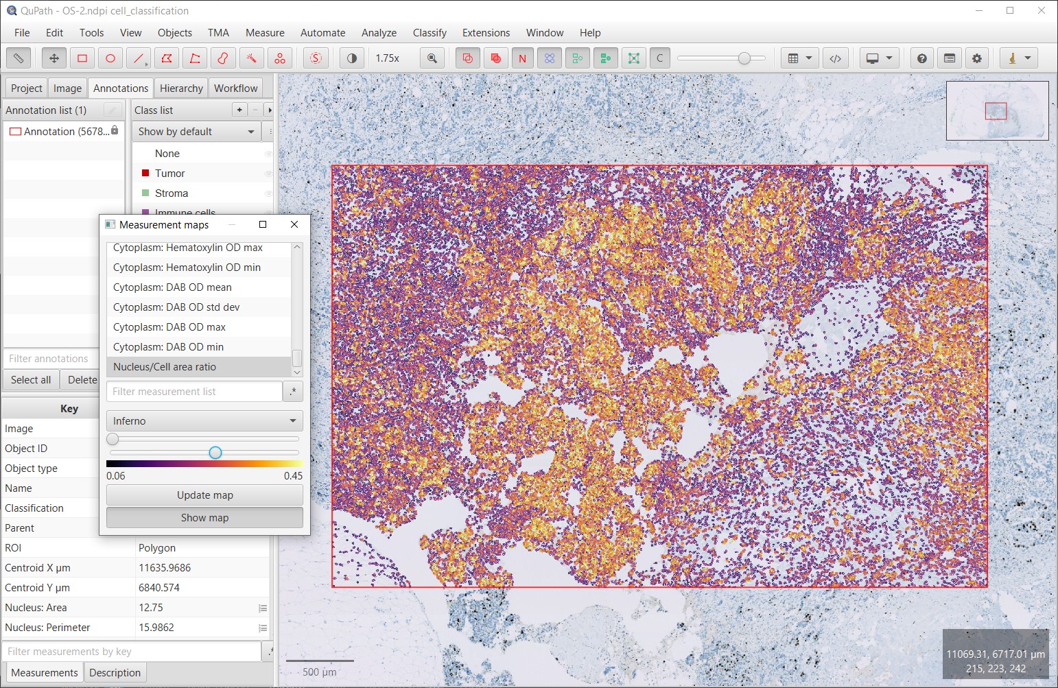 ../../_images/ki67_auto_map_raw.jpg