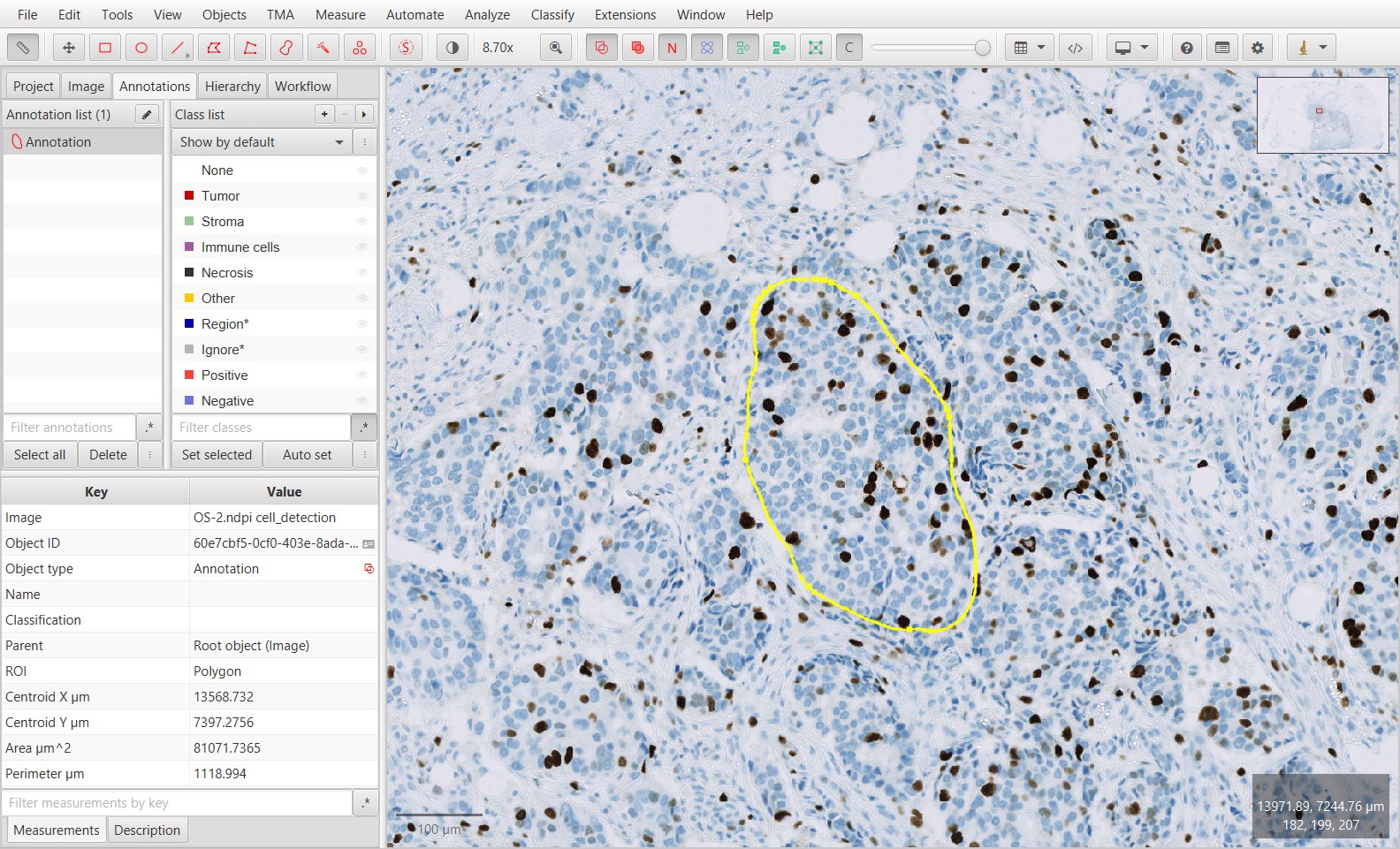 ../../_images/ki67_detecting_annotation.jpg