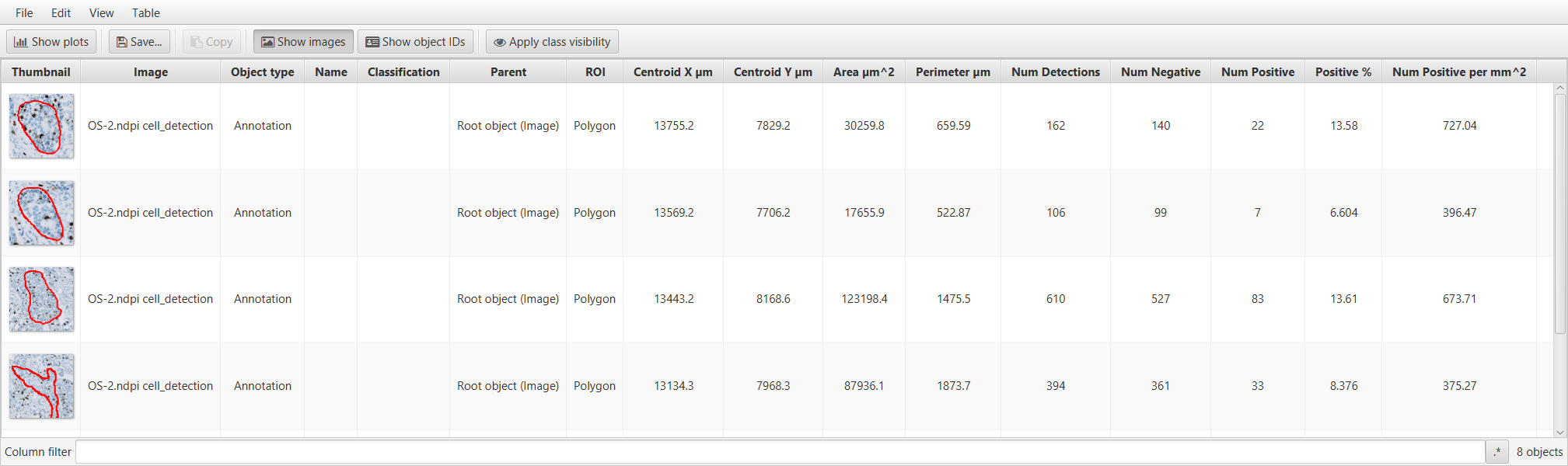 ../../_images/ki67_detecting_results_annotations.png