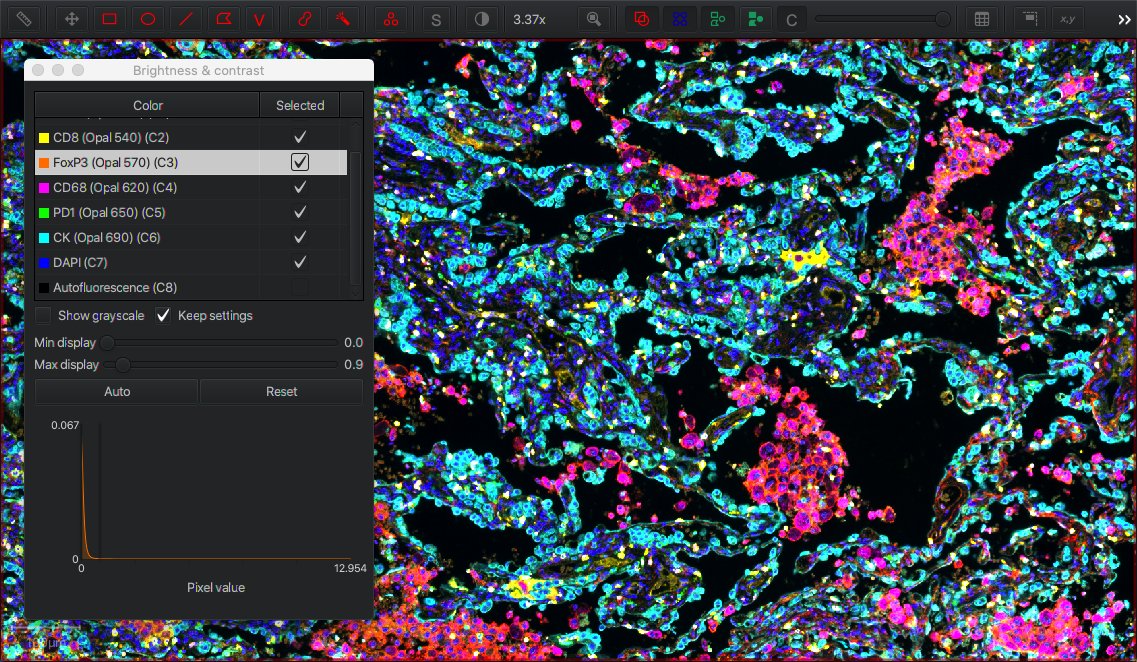 ../../_images/multichannel_contrast.jpg