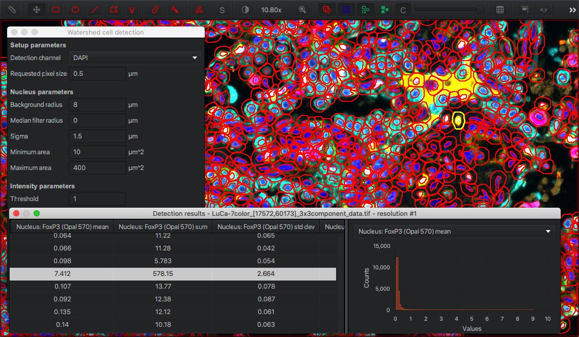 ../../_images/multichannel_detection.jpg