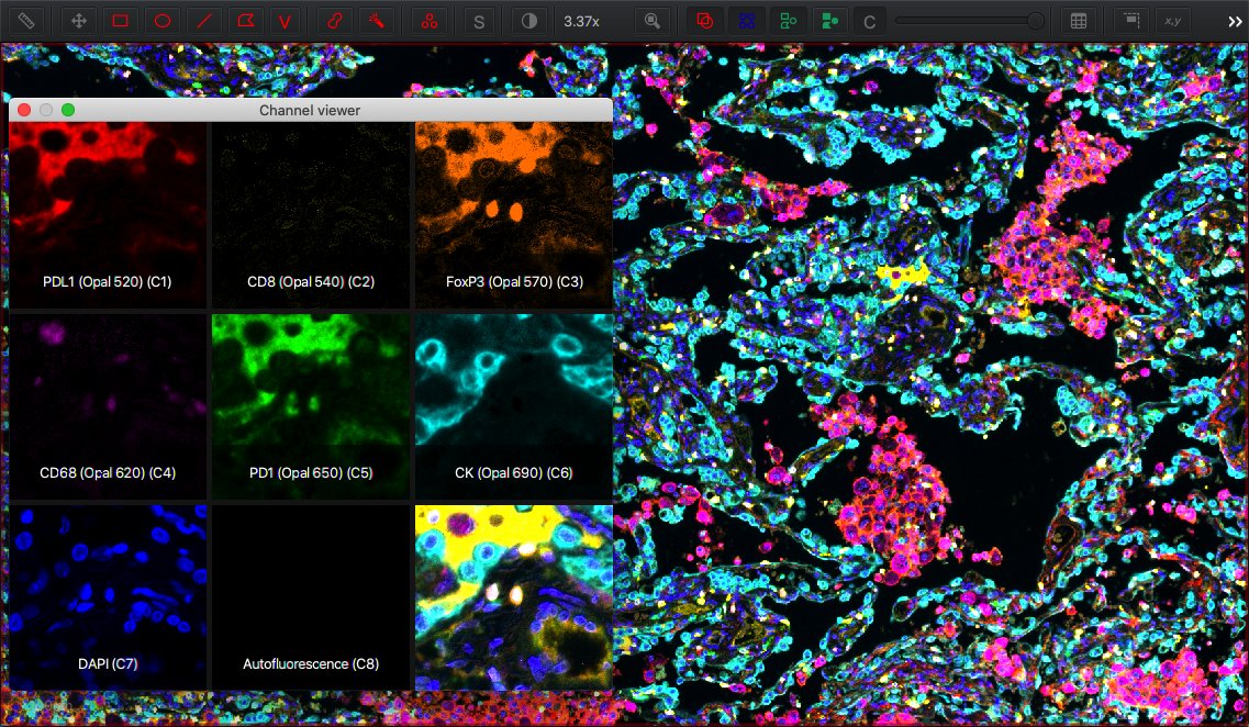 ../../_images/multichannel_viewer.jpg