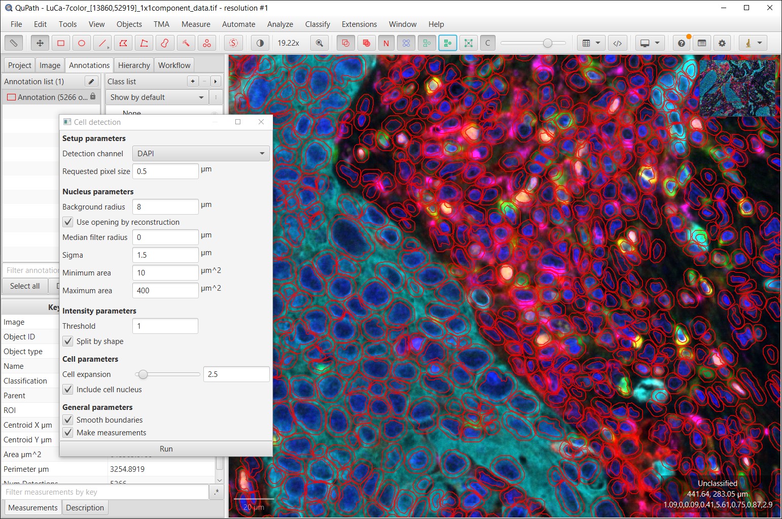 ../../_images/multiplex_cells.jpg