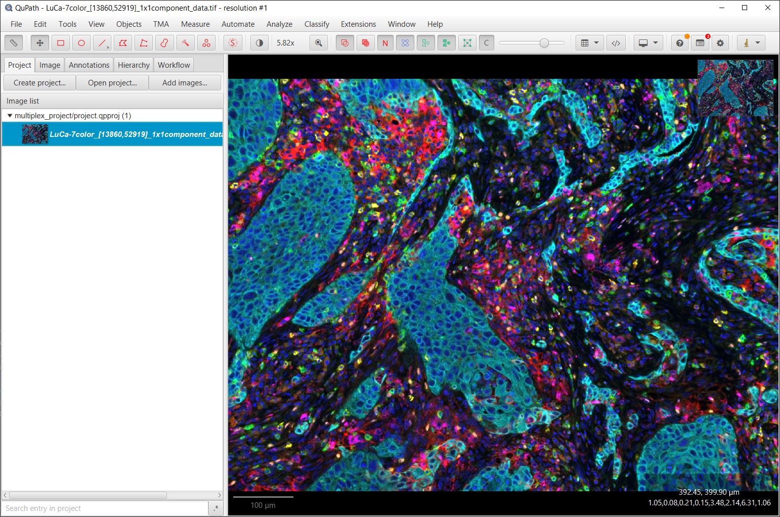 ../../_images/multiplex_project.jpg