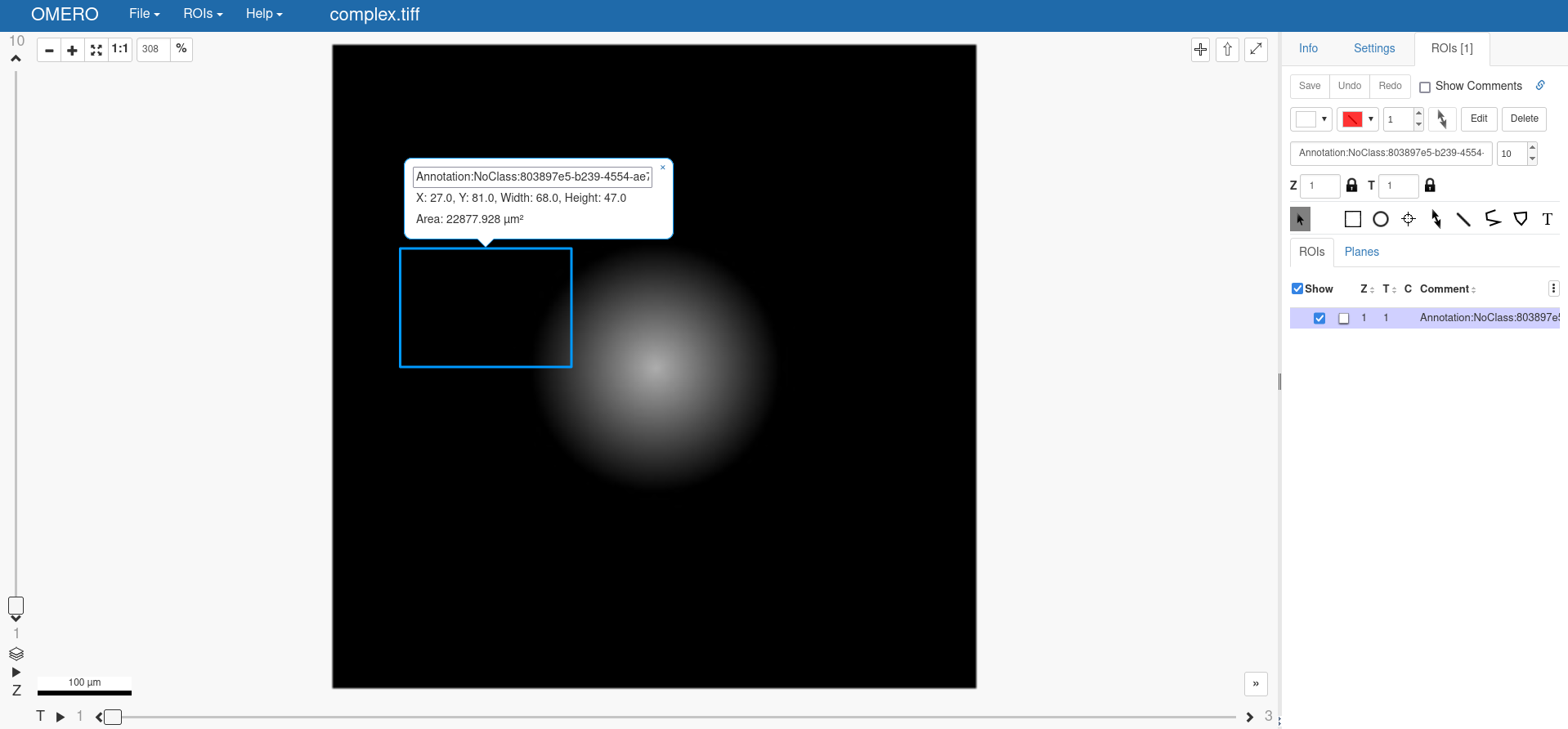 ../../_images/omero_annotation.png