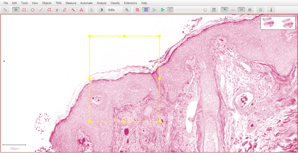 ../../_images/stains_estimate_e.jpg