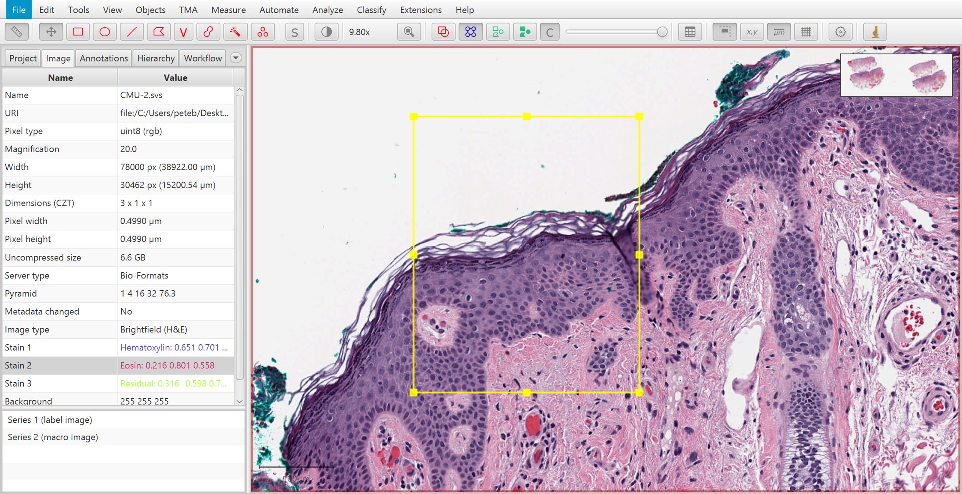 ../../_images/stains_estimate_region.jpg