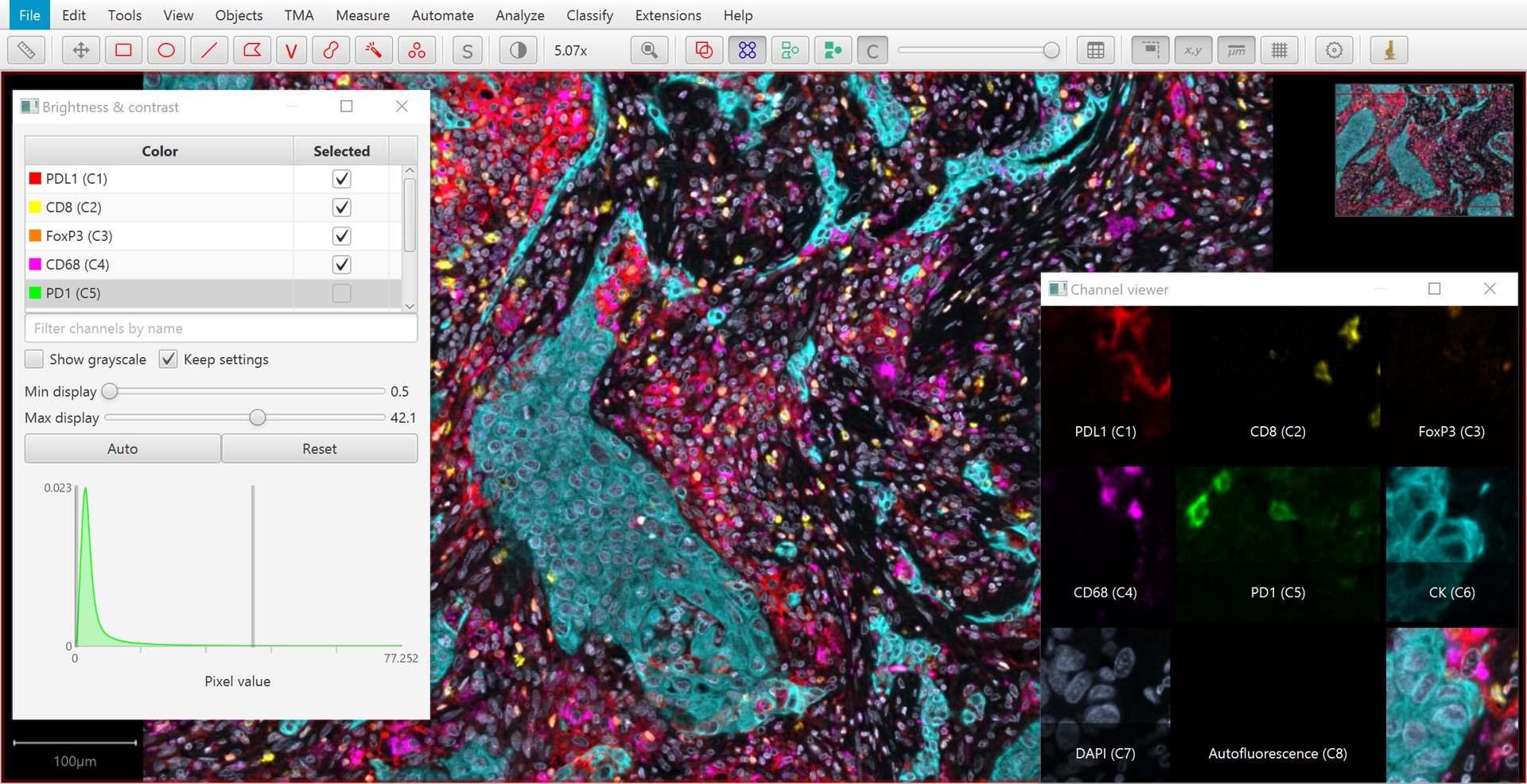 ../../_images/stains_multiplexed.jpg