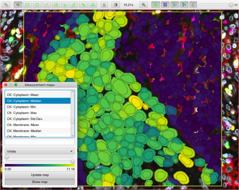 ../../_images/stardist_cells_luca.jpg
