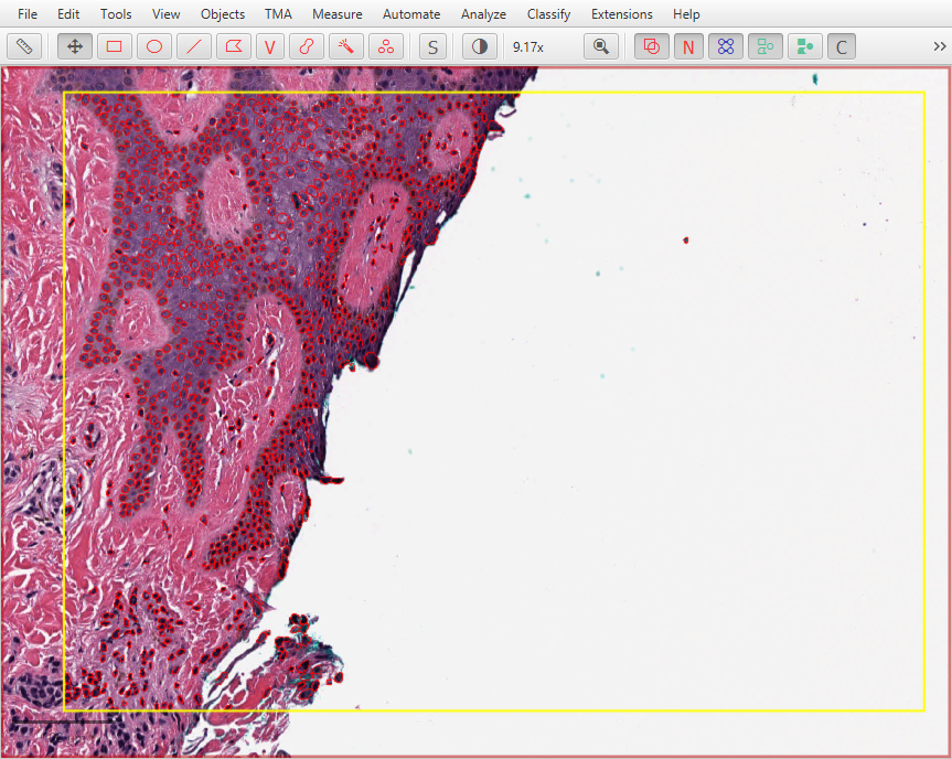 ../../_images/stardist_normalize_global_fix.jpg