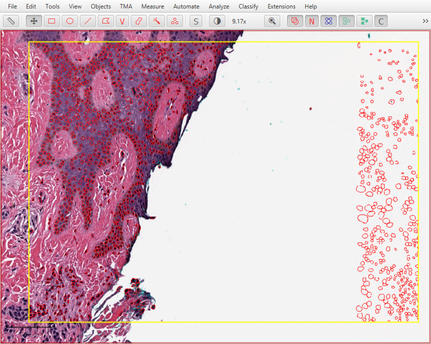 ../../_images/stardist_normalize_local_bug.jpg