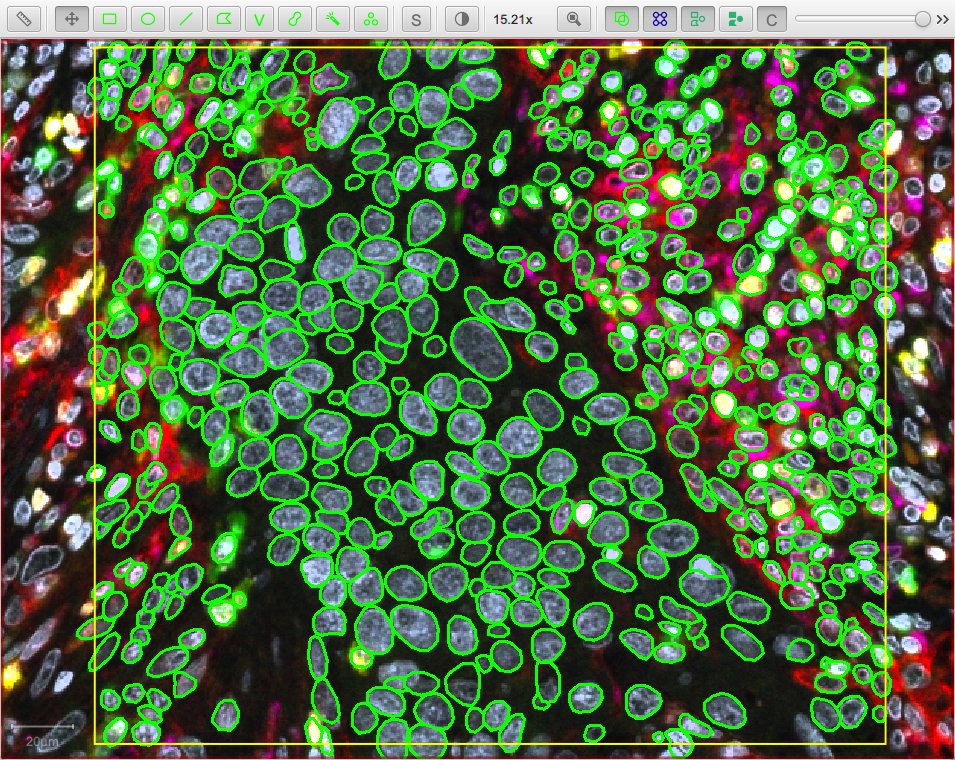 ../../_images/stardist_nuclei_luca.jpg