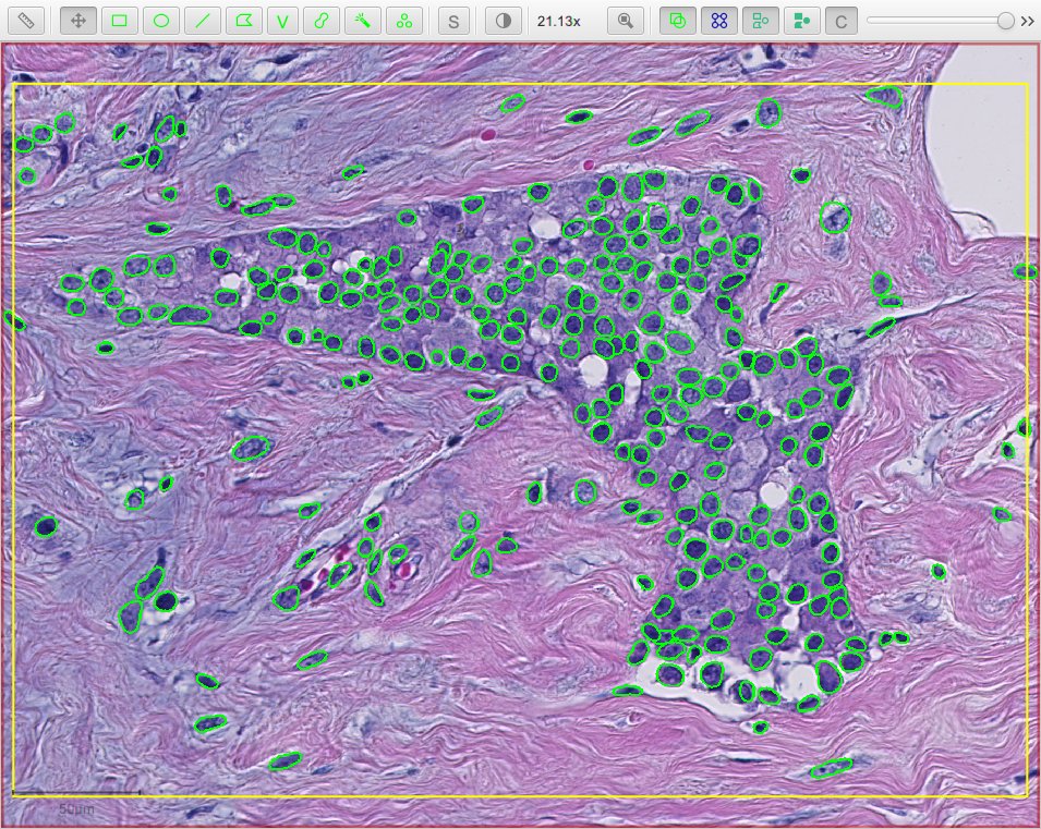 ../../_images/stardist_nuclei_os1.jpg