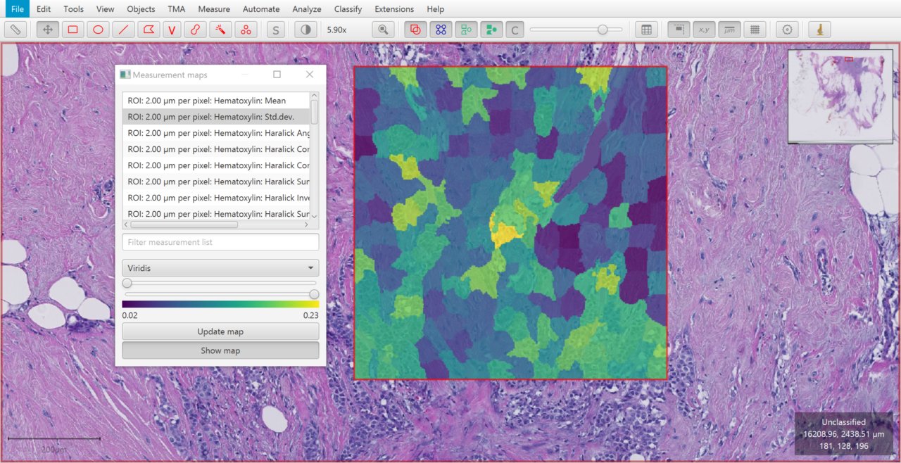 ../../_images/superpixels_heatmap.jpg