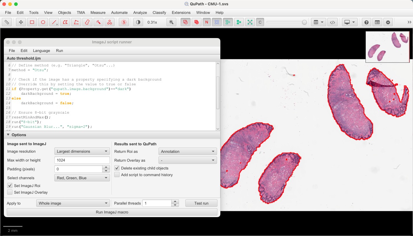 ../../_images/imagej_script_otsu.jpg