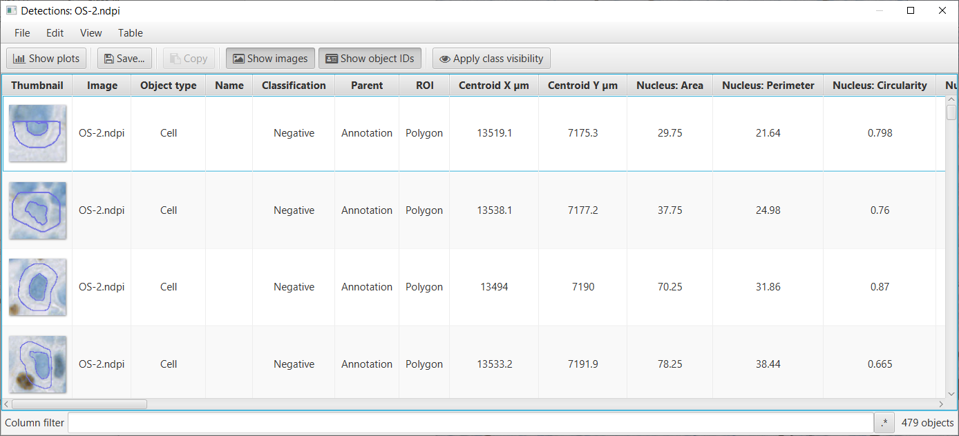 ../../_images/ki67_detecting_results_detections.png