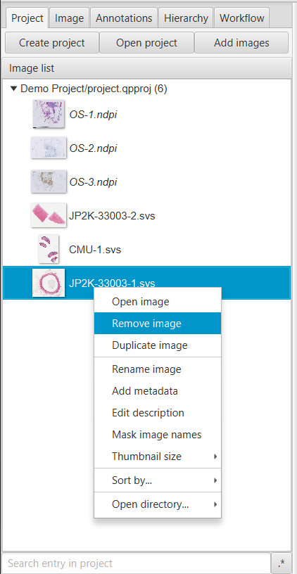../../_images/project_remove_image.png